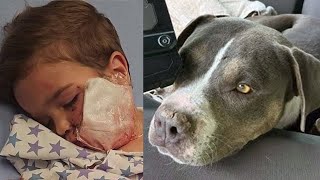 Pit Bull attacks toddler after a balloon popped