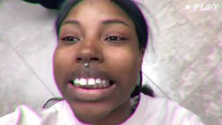 VLOG: VENEERS OR BRACES ?! | A B**** FINALLY GOT MY TEETED FIXED