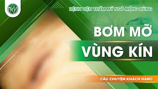 May Tầng Sinh Môn, Bơm Mỡ Vùng Kín | Bác Sĩ Ngô Mộng Hùng #ngomonghung