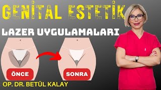 GENİTAL ESTETİK, LAZER UYGULAMALARI, RENK AÇMA, İDRAR KAÇIRMA, DR. BETÜL KALAY