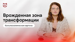 Врожденная зона трансформации. Оформление протокола кольпоскопии в «Кольпоэксперт»