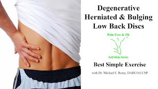 Degenerative Disc Disease, Herniated & Bulging Discs L1, L2 L3 L4 L5 S1- Best Simple Exercise