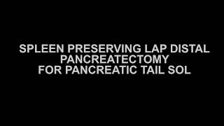 Spleen Preserving Lap Distal Pancreatectomy for Pancreatic Tail Soil- Dr Atul Mishra