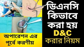 D&C procedure - ডিএনসি কিভাবে করা হয়। পূর্বপ্রস্তুতি। ডি এন সি করার নিয়ম- dnc