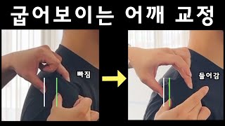 ❌라운드숄더라고 많이들 착각하는  ⭕️상완골두 전방활주 교정 방법