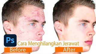 Get rid of pimples in photoshop (Menghilangkan jerawat)