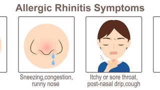 🔹Acupuncture & Acupressure for Allergic Rhinitis ( nasal allergy )