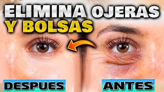 Elimina BOLSAS ARRUGAS y OJERAS con Gimnasia Facial