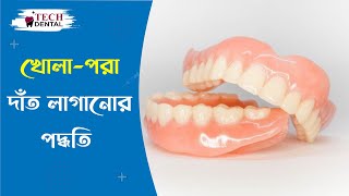 Complete denture