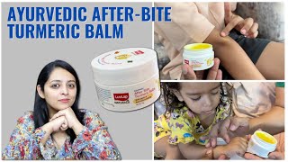 LuvLap Ayurvedic After Bite Balm Review