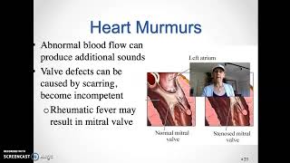 ALH Cardiac Flow #2