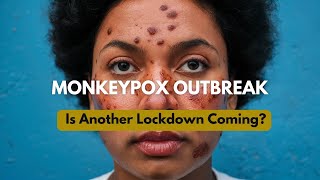 Monkeypox (Mpox) Outbreak 2024: Symptoms, Spread, and Prevention? Pandemic Lockdown? Virus Cases