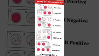 Blood grouping chart #medical #viralvideo #youtubeshorts #youtube #shorts #medicallabtech #mbbs#lab