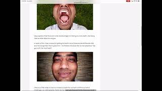 Indian man has record 37 teeth on Guinness World Records 2015 - 5 extra teeth