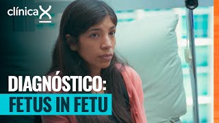 Beatriz necesita ser operada para extraer la masa de su espalda | Clínica X