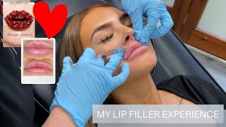 I GOT MY LIPS DONE!!!! | MY LIP FILLER EXPERIENCE | MY CHRISTMAS PRESENT TO ME | VLOG 2019