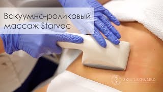 Вакуумно-роликовый массаж Старвак Starvac для коррекции фигуры