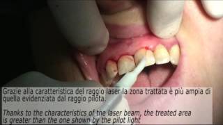 Periodontics