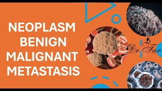 Lesson1. Mastering Medical Terms: Neoplasm, Benign, Malignant, and Metastasis