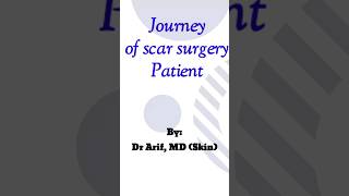 Face scar surgery@DesignerDoctor #shorts #scars #scartreatment #viral