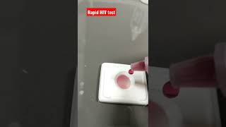 #hivtest 🩸🔥#laboratory #medical #youtubeshorts #bloodtest #short #lablife #trending #trend #mlt