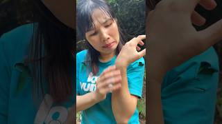 survival Skills:The girl has the skill to treat itching caused by insect bites. #bushcraft #funny