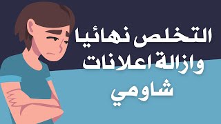 افضل طريقة للتخلص من اعلانات اجهزة شاومي نهائيا