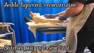 Post Ankle ligament reconstruction surgery