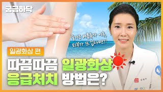 따끔따끔 일광화상 응급처치 방법은? 🔅일광화상 편│궁금하닥