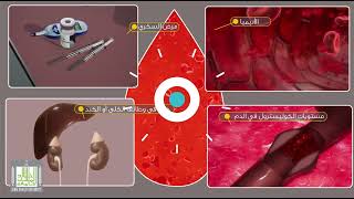 01الطريقة الصحيحة لسحب عينة الدم    Blood Sampling