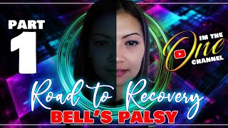 Bells Palsy Road to Recovery 10 days