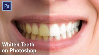 How to whiten teeth in photoshop | ARStudio | 2022 | Photoshop Tutorial