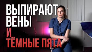 Выпирают вены и тёмные пятна на ногах после удаления варикоза