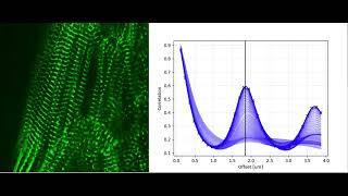 View of contracting sarcomeres in hiPSC-CMs expressing ACTN2-GFP and the SotaTool output graphs