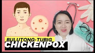 CHICKENPOX (BULUTONG-TUBIG): SINTOMAS, SANHI, PAGGAMOT, KOMPLIKASYON AT PAG-IWAS | ATE NURSE