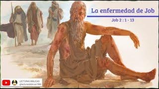 La enfermedad de Job-Job 2:1-13