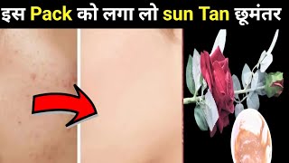 Sun Tan अब मिनटों में गायब ,एक बार इस पैक को लगा लो |How To Remove Tanning | The Buffs Glam