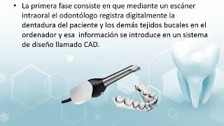 Prótesis dentales en CAD-CAM