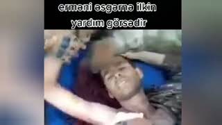 erməni əsgərinə Azərbaycan Əsgəri ilkin yardım görsədir yeni