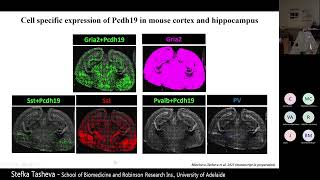 Cell‐ and region‐specific Pcdh19 expression and elimination:elimination: insights into PCDH19...