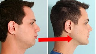 How to Improve Jawline | Jawline Exercise