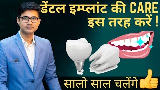 Dentist Explains: How to take care of your dental implants | डेंटल इम्प्लांट का ध्यान कैसे रखे