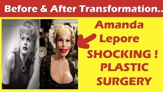 Amanda Leopore Plastic Surgery Before and After Full HD