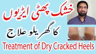 Best Home Remedy to Treat Dry Cracked Heels | Cracked Heels Treatment in Urdu | Phati Ariyan Ka Elaj