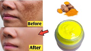 Magical Brightening Turmeric Creme/In 3 Day it removes pigmentation, dark spots, and treats melasma