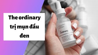 Review the ordinary trị mụn đầu đen có tốt không? Giá bao nhiêu? Mua ở đâu