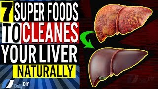 Cleanse Your Liver Naturally 7 Foods That You Should Include in Your Diet