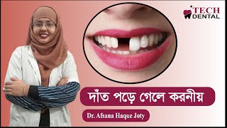 দাঁত পরে গেলে করনীয় II Tech Dental