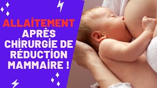 Allaitement Après Chirurgie De Réduction Mammaire !