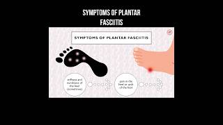 Symptoms of plantar fasciitis #plantarfasciitis #fasciitis #footpain #legpain